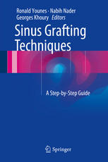 Sinus Grafting Techniques A Stepbystep Guide 1st Edition Ronald Younes