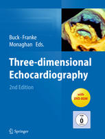 Threedimensional Echocardiography 2nd Edition Prof Dr Thomas Buck