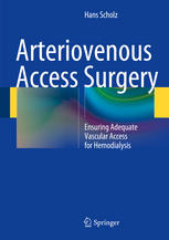 Arteriovenous Access Surgery Ensuring Adequate Vascular Access For Hemodialysis 2nd Edition Hans Scholz Auth
