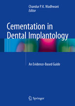 Cementation In Dental Implantology An Evidencebased Guide 1st Edition Chandur Pk Wadhwani Eds