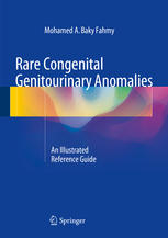 Rare Congenital Genitourinary Anomalies An Illustrated Reference Guide 1st Edition Mohamed A Baky Fahmy