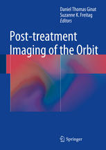 Posttreatment Imaging Of The Orbit 1st Edition Daniel Thomas Ginat