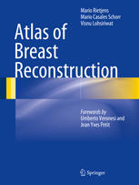 Atlas Of Breast Reconstruction 1st Edition Mario Rietjens Mario Casales Schorr