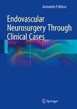 Endovascular Neurosurgery Through Clinical Cases 1st Edition Aristotelis P Mitsos