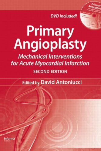 Primary Angioplasty Mechanical Interventions For Acute Myocardial Infarction 2nd Edition David Antoniucci