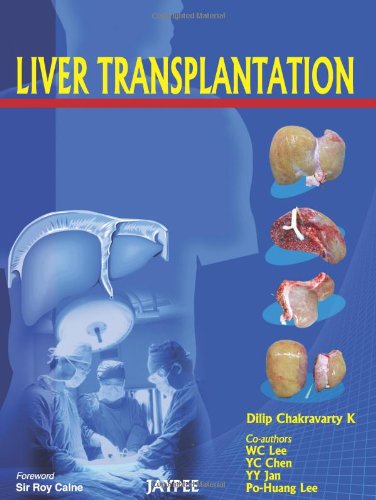 Liver Transplantation 1st Edition Chakravarty