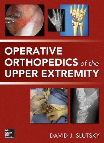 Operative Orthopedics Of The Upper Extremity 1st Edition David Slutsky