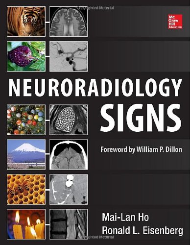 Neuroradiology Signs 1st Edition Mailan Ho Ronald L Eisenberg