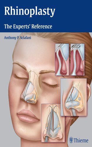 Rhinoplasty The Experts Reference 1st Edition Anthony P Sclafani