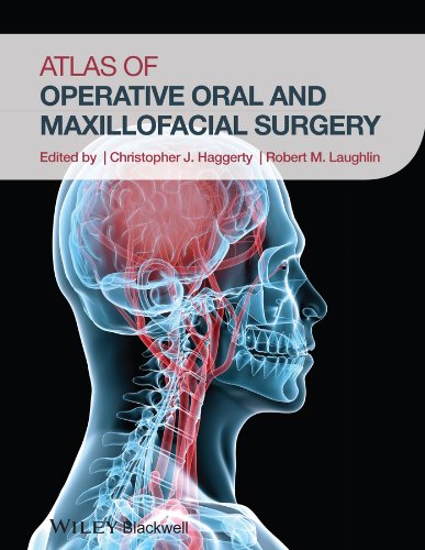 Atlas Of Operative Oral And Maxillofacial Surgery 1st Edition Christopher J Haggerty