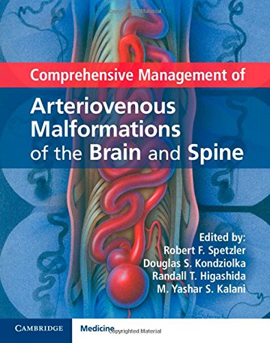 Comprehensive Management Of Arteriovenous Malformations Of The Brain And Spine 1st Edition Robert F Spetzler