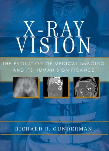 Xray Vision The Evolution Of Medical Imaging And Its Human Significance Richard B Gunderman