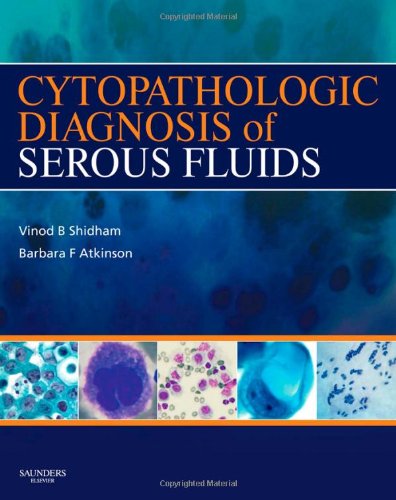 Cytopathologic Diagnosis Of Serous Fluids 1st Vinod B Shidham
