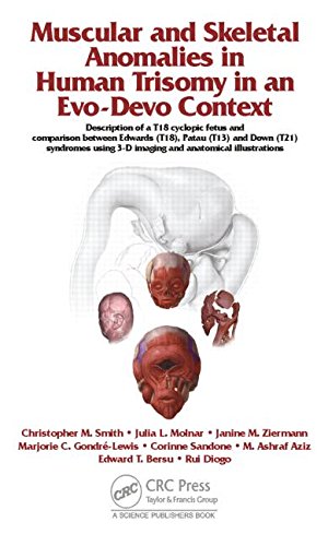 Muscular And Skeletal Anomalies In Human Trisomy In An Evodevo Context Description Of A T18 Cyclopic Fetus And Comparison Between Edwards 1st Edition Rui Diogo