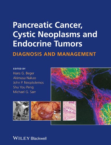 Pancreatic Cancer Cystic Neoplasms And Endocrine Tumors Diagnosis And Management 1st Edition Hans G Beger