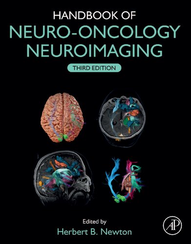 Handbook Of Neurooncology Neuroimaging 3rd Edition Herbert B Newton