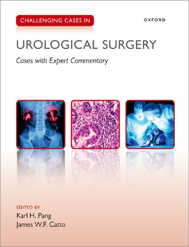 Challenging Cases In Urological Surgery Karl Pang
