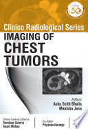 Clinico Radiological Series Imaging Of Chest Tumors Ashu Seith Bhalla
