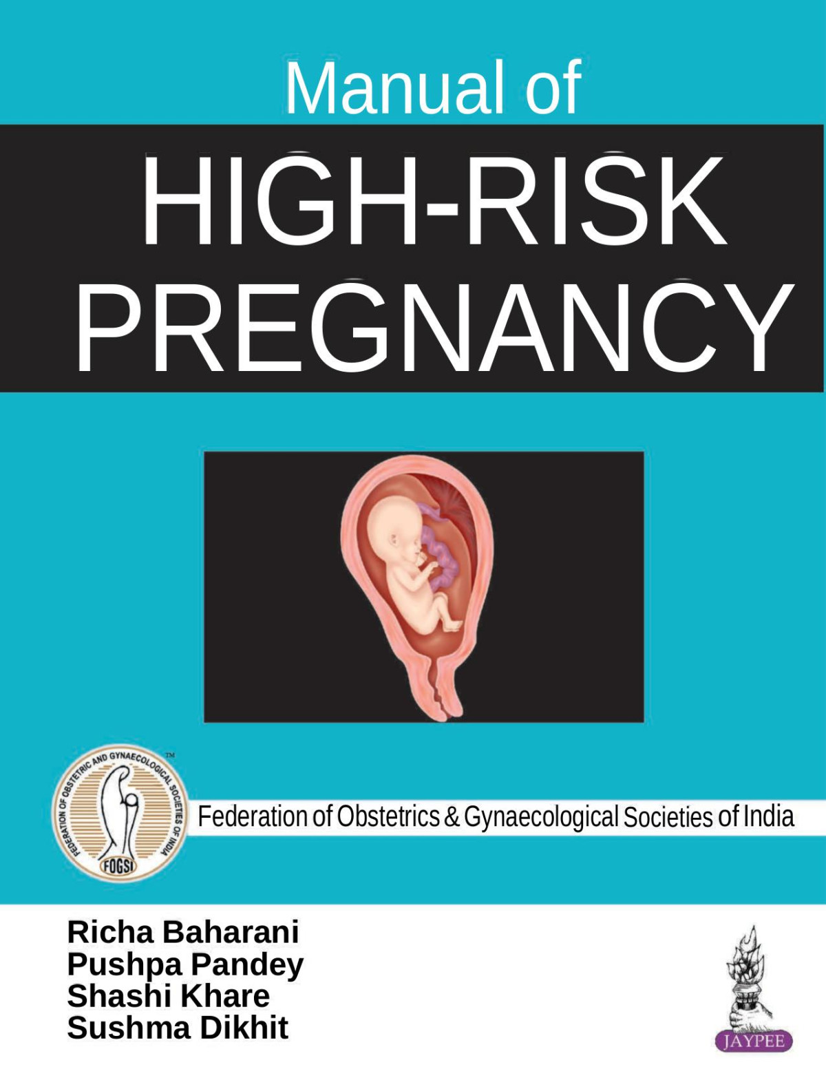 Manual Of Highrisk Pregnancy Richa Baharani Pushpa Pandey Shash Khare