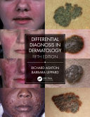 Differential Diagnosis In Dermatology Richard Ashton Barbara Leppard
