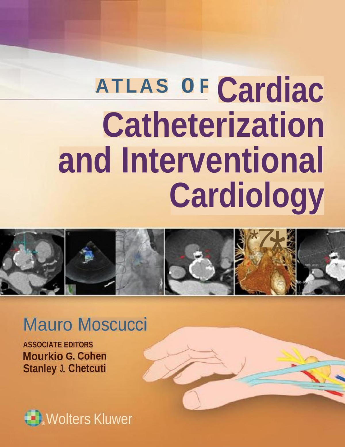 Atlas Of Cardiac Catheterization And Interventional Cardiology Mauro Moscucci