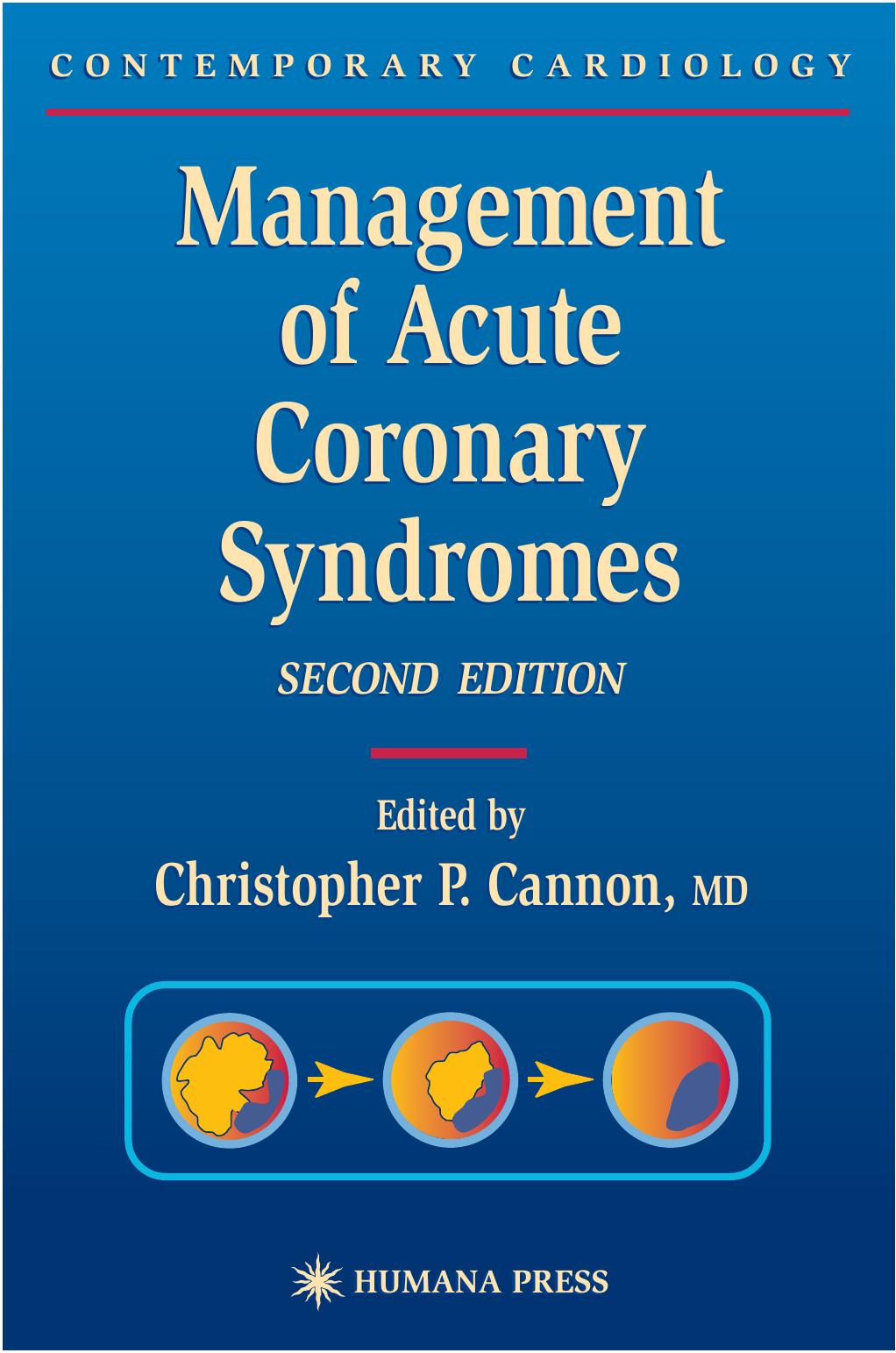 Management Of Acute Coronary Syndromes 2nd Christopher P Cannon