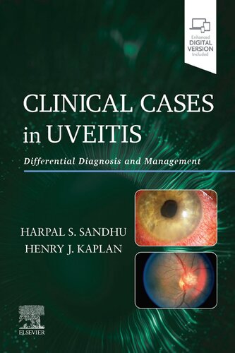 Clinical Cases In Uveitis Harpal Sandhu Henry J Kaplan