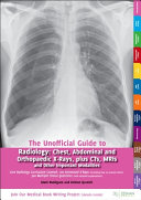 Unofficial Guide To Radiology Chest Abdominal And Orthopaedic Xrays Plus Cts Mris And Other Important Modalities 1st Edition Mark Rodrigues Zeshan Qureshi Editors