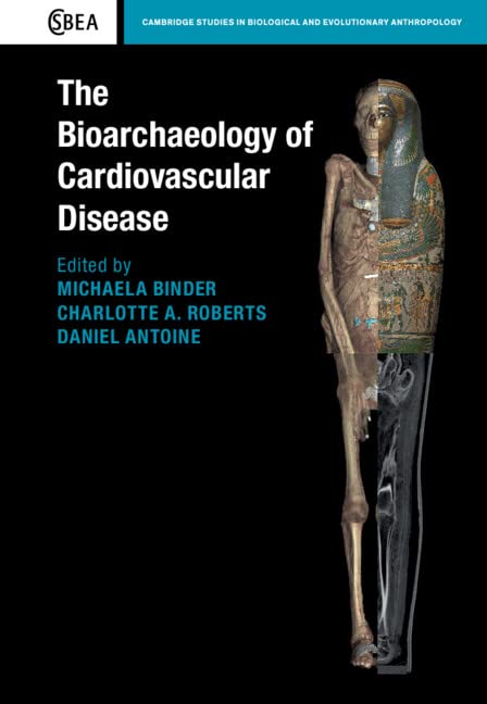 The Bioarchaeology Of Cardiovascular Disease Michaela Binder