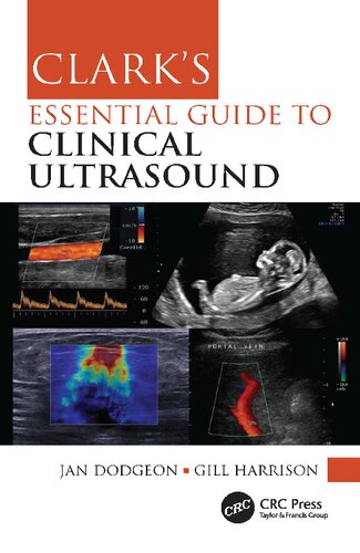Clarks Essential Guide To Clinical Ultrasound 1st Jan Dodgeon