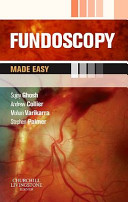 Fundoscopy Made Easy Oct 7 20100702042978churchill Livingstone Sujoy Ghosh