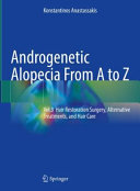 Androgenetic Alopecia From A To Zvol3 Hair Restoration Surgery Alternative Treatments And Hair Care Konstantinos Anastassakis