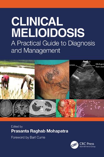 Clinical Melioidosis A Practical Guide To Diagnosis And Management 1st Prasanta Raghab Mohapatra