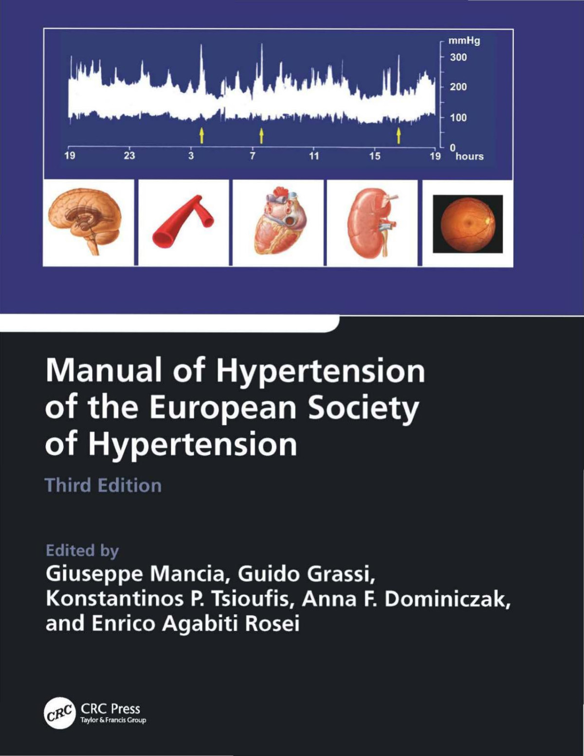 Manual Of Hypertension Of The European Society Of Hypertension Giuseppe Mancia