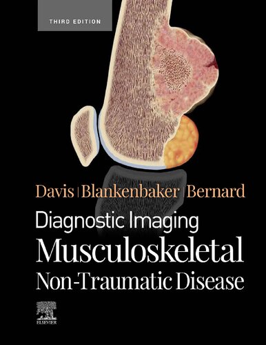 Diagnostic Imaging Musculoskeletal Nontraumatic Disease 3rd Edition Authors Kirkland W Davis
