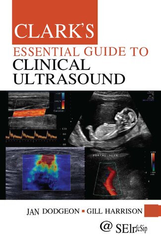 Clarks Essential Guide To Clinical Ultrasound Jan Dodgeon Gill Harrison