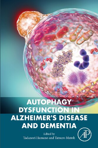 Autophagy Dysfunction In Alzheimers Disease And Dementia Tadanori Hamano