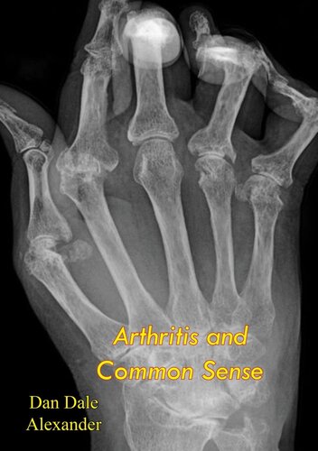 Arthritis And Common Sense Dan Dale Alexander