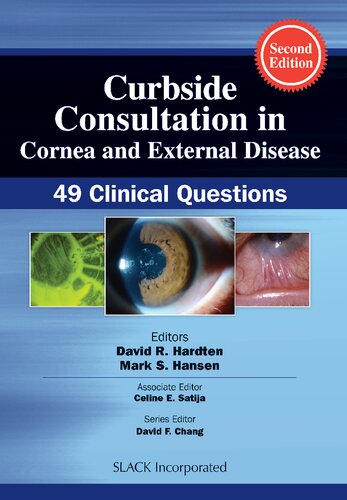 Curbside Consultation In Cornea And External Disease 49 Clinical Questions 2nd Edition David R Hardten Md Facs