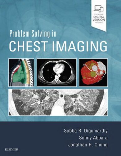 Problem Solving In Chest Imaging 2019 1st Edition Subba R Digumarthy Md