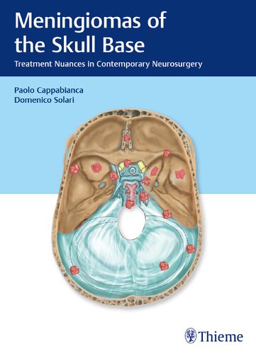 Meningiomas Of The Skull Base Treatment Nuances In Contemporary Neurosurgery Paolo Cappabianca Editor