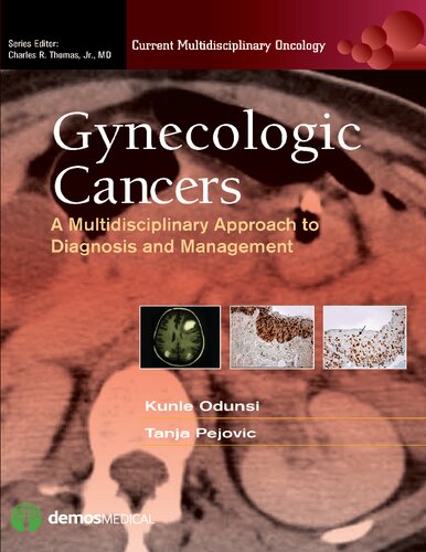Gynecologic Cancers A Multidisciplinary Approach To Diagnosis And Management Kunle Odunsi