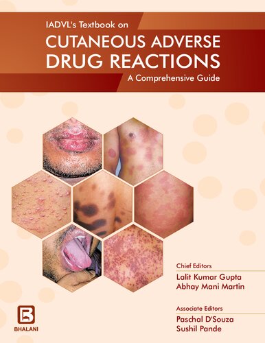 Iadvl Textbook On Cutaneous Adverse Drug Reactions 1st Edition Lalit Kumar Gupta