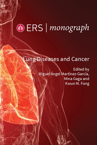 Lung Diseases And Cancer Miguel Angel Martinez Garcia Mina Gaga And Kwun M Fong