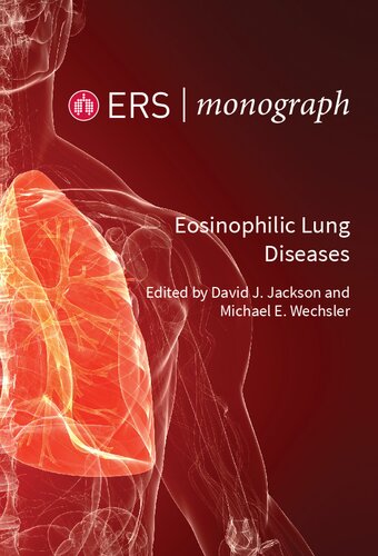 Eosinophilic Lung Disease David Jackson And Michael Wechsler