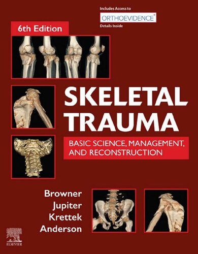 Skeletal Trauma Basic Science Management And Reconstruction 2volume Set 6th Edition 6th Edition Bruce Browner