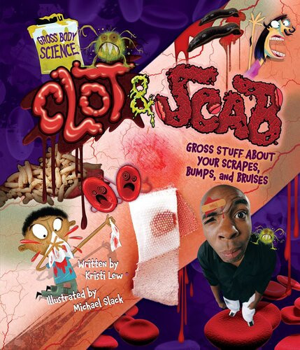 Clot Scab 1st Edition Kristi Lew