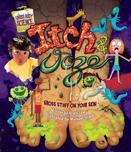 Itch Ooze Gross Stuff On Your Skin Readalong Ebook Laura Christin Lewandowski