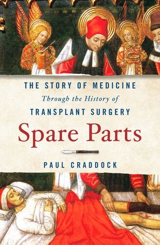 Spare Parts The Story Of Medicine Through The History Of Transplant Surgery Paul Craddock
