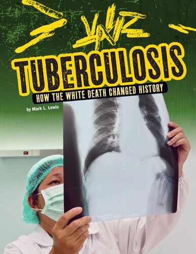 Tuberculosis Mark K Lewis